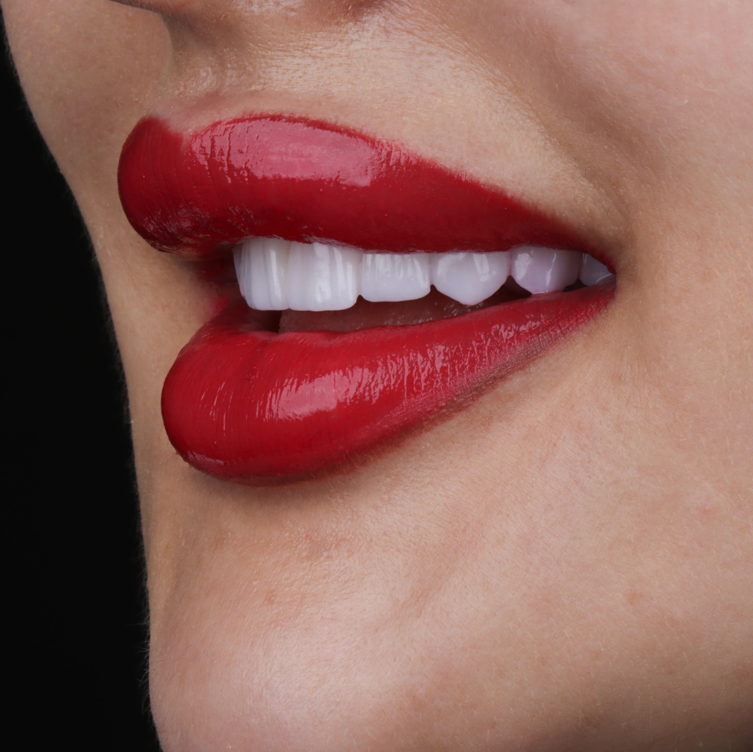 Close-up of a finished smile