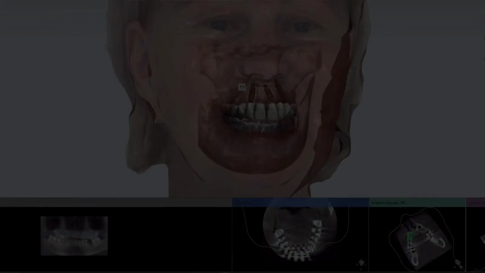 A three-dimensional facial and dental scan on screen