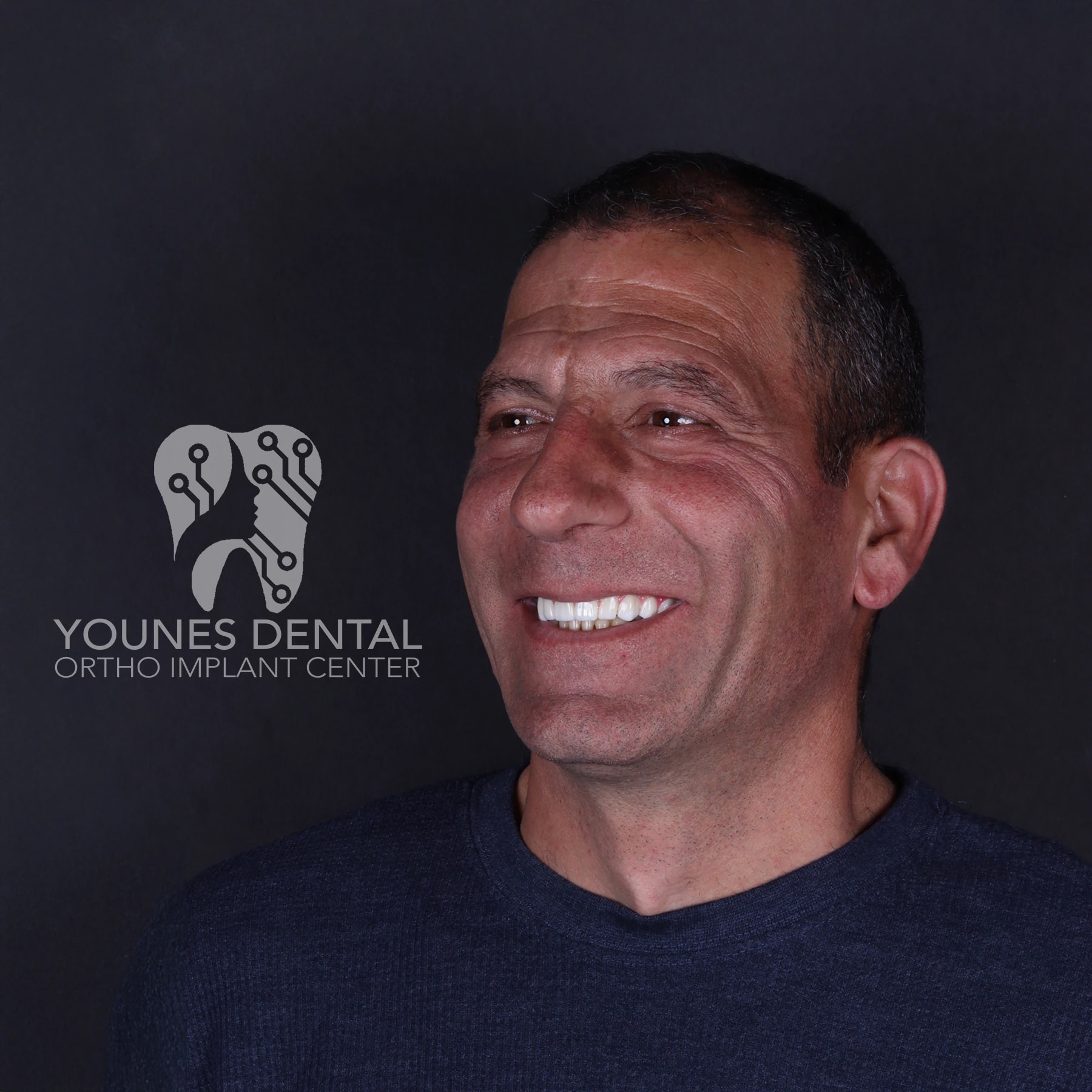 All on 4 — patient result