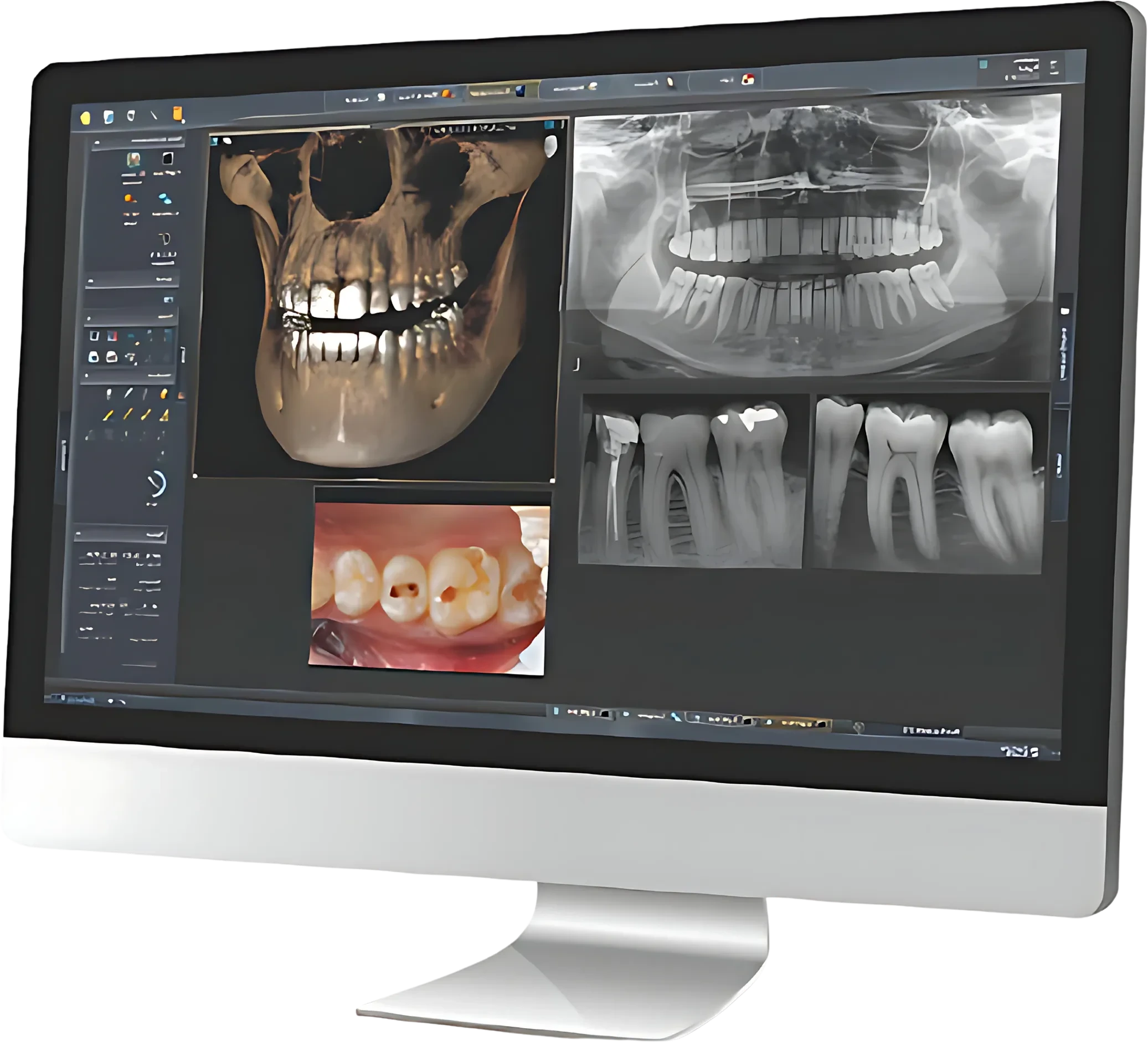 3D X-ray (CBCT)